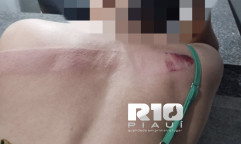 Mulher é agredida com facão em Piripiri após filho advogado acionar ex-inquilino na Justiça