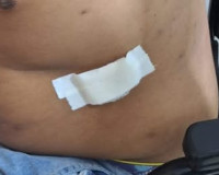 Homem é baleado no abdômen em tentativa de homicídio