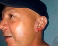 Homem tem pedaço da orelha arrancado por mulher após beijo durante festa em Piripiri