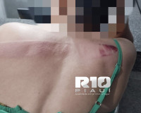 Mulher é agredida com facão em Piripiri após filho advogado acionar ex-inquilino na Justiça