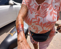 Idosa de 75 anos é agredida com chave de moto em Piripiri
