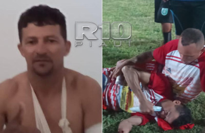 Ex-jogador do 4 de Julho sofre fratura exposta durante partida de futebol
